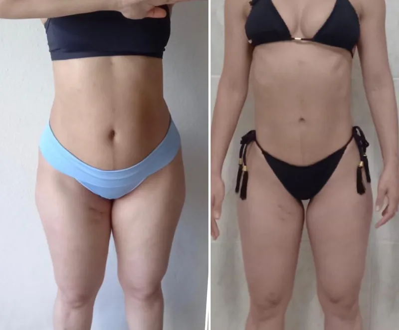 Antes e depois de aluna: abdômen e pernas